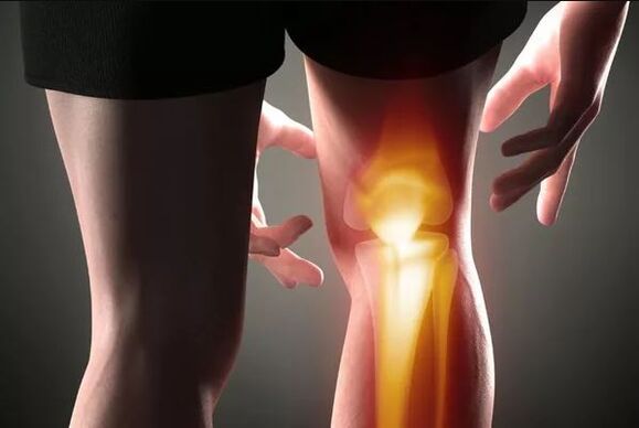 Arthrosis sa lutahan sa tuhod