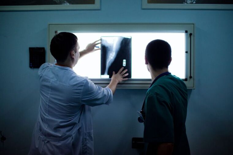 Diagnosis sa Arthrosis sa X -ray