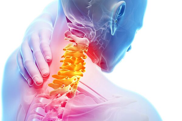 Ang cervical osteochondrosis