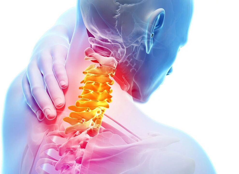 Ang cervical osteochondrosis