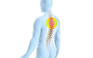 osteochondrosis sa thoracic spine