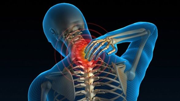 Kasakit sa diha nga milingi sa liog mahimong nagpakita vertebral cervical osteochondrosis syndrome