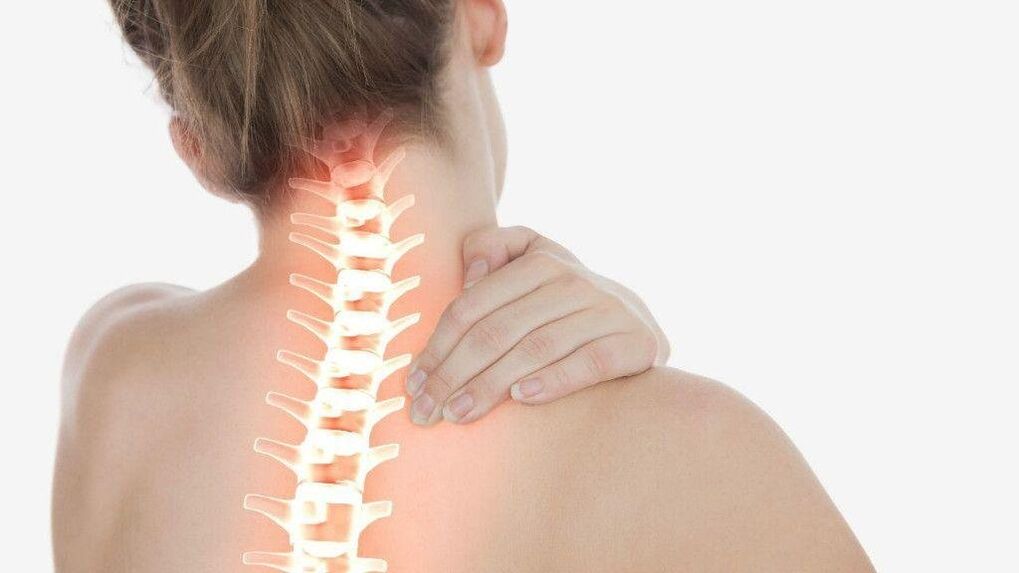 Sa osteochondrosis sa cervical spine, ang radicular syndrome mahimong molambo